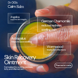 Calm Balm - Flare Relief and Comfort